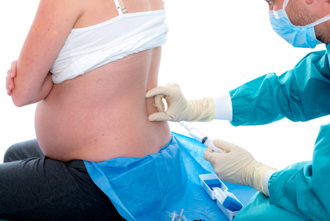 An Overview of Epidural Steroid Injections