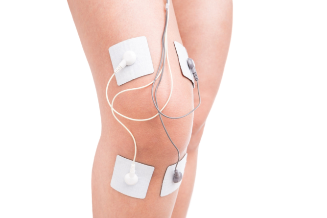 A Guide to Peripheral Nerve Stimulation